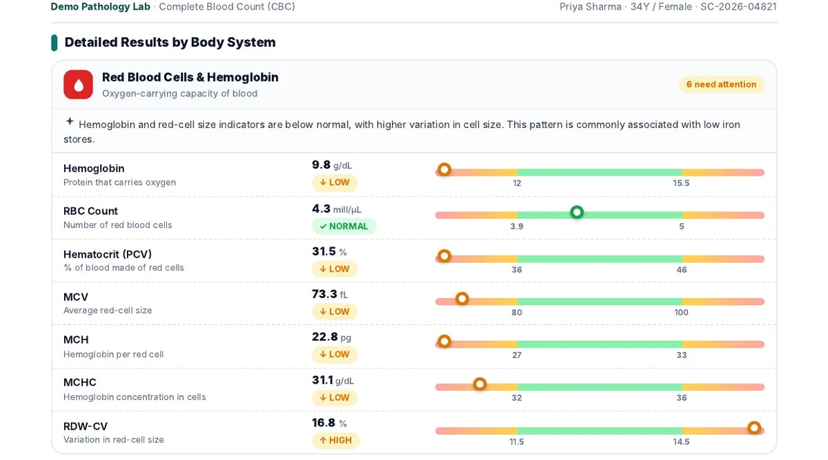 Range bars in an AI Smart Report showing hemoglobin, MCV and other CBC values with Normal, Low and High badges